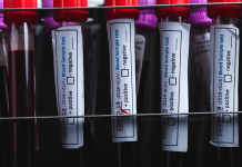 Why politicians should be wary of publicly pursuing the Wuhan lab-leak investigation covid