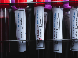 Why politicians should be wary of publicly pursuing the Wuhan lab-leak investigation covid